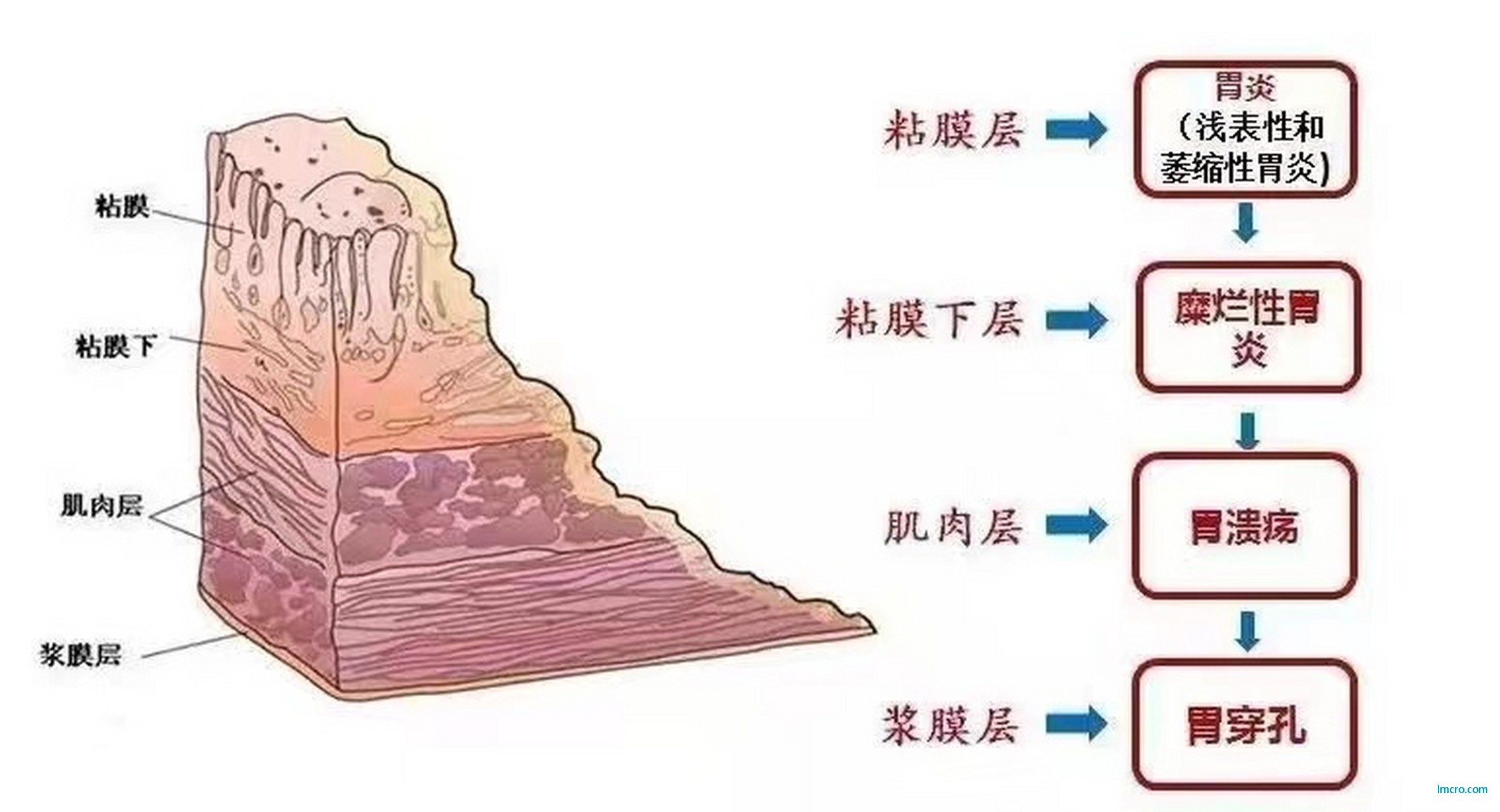 39850bd975398f477b8a440d0cdc8eb3.jpeg