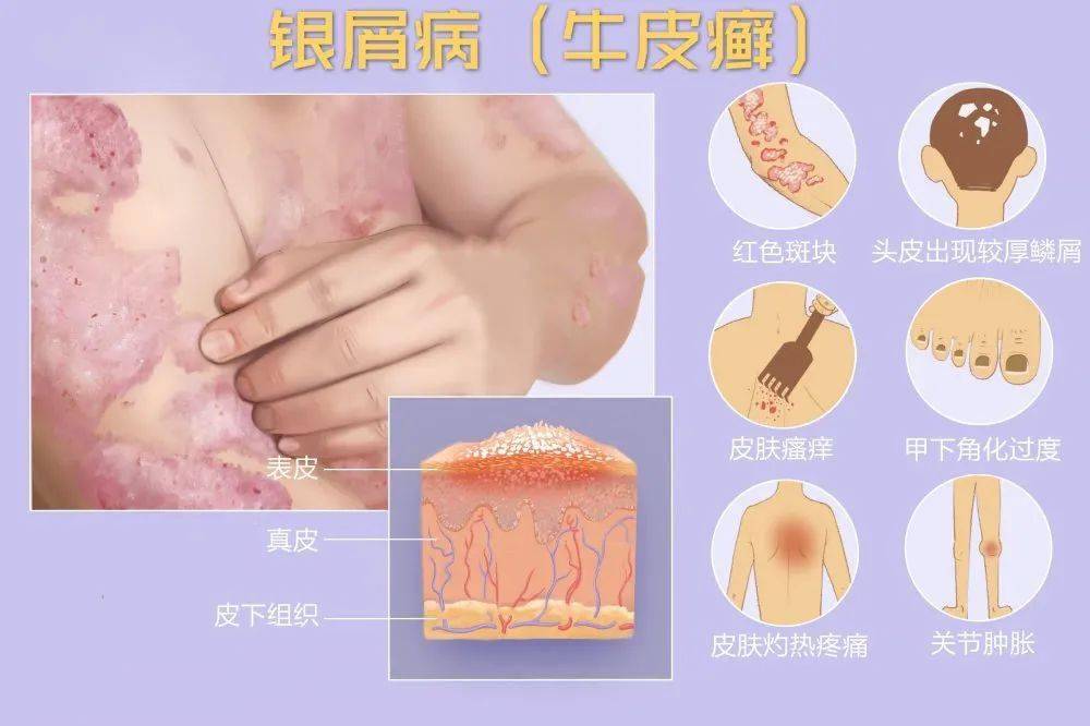 临床先锋